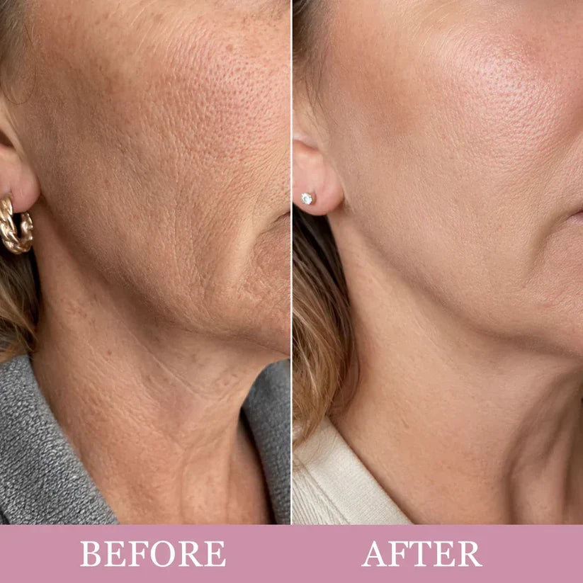 ✨Last Day Buy 1 Get 1 Free ✨Mirevyn  Collagen Gua Sha Neck Wrinkle Cream Skincare