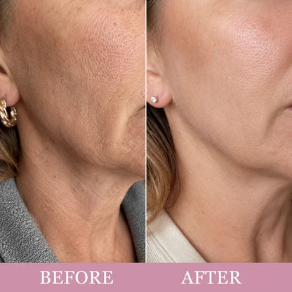 ✨Last Day Buy 1 Get 1 Free ✨Mirevyn  Collagen Gua Sha Neck Wrinkle Cream Skincare