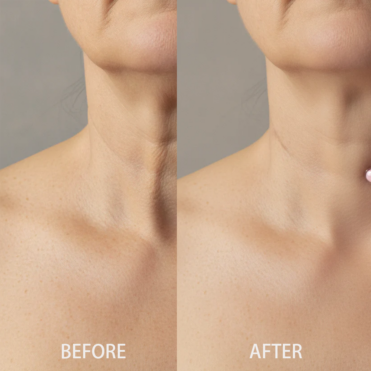 ✨Last Day Buy 1 Get 1 Free ✨Mirevyn  Collagen Gua Sha Neck Wrinkle Cream Skincare